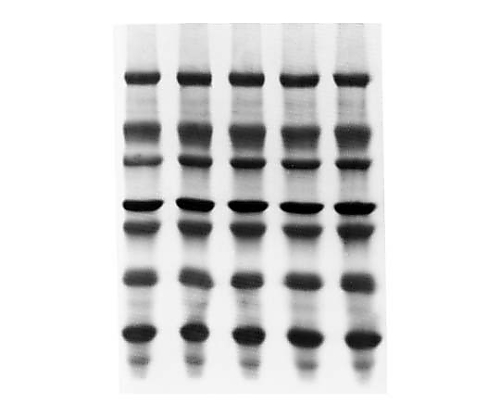 Immobilon-PSQ PVDF 0.2um 26.5cmx3.75m roll 1/Pk 1PK ISEQ00010